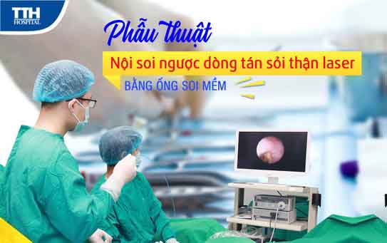 NỘI SOI NGƯỢC DÒNG TÁN SỎI TIẾT NIỆU LASER BẰNG ỐNG SOI MỀM