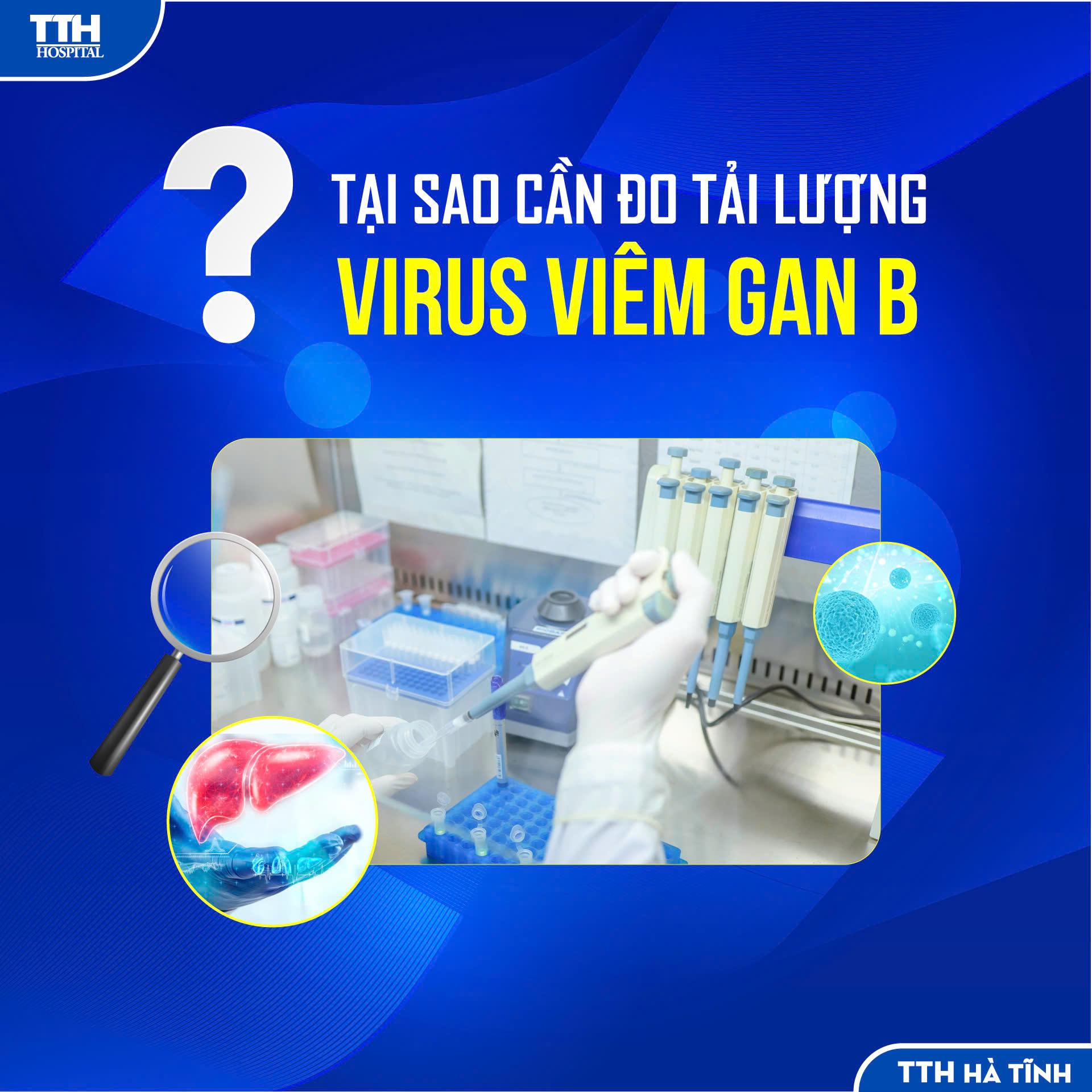 TẠI SAO CẦN ĐO TẢI LƯỢNG VIRUS VIÊM GAN B?