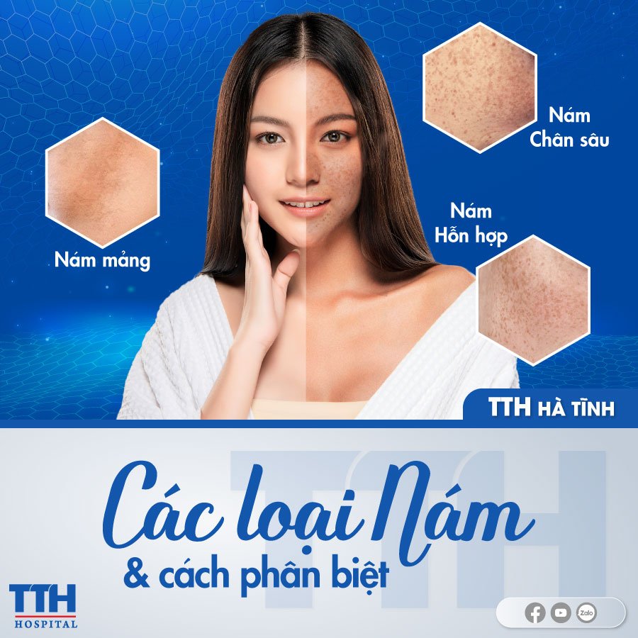 Các loại nám và cách phân biệt